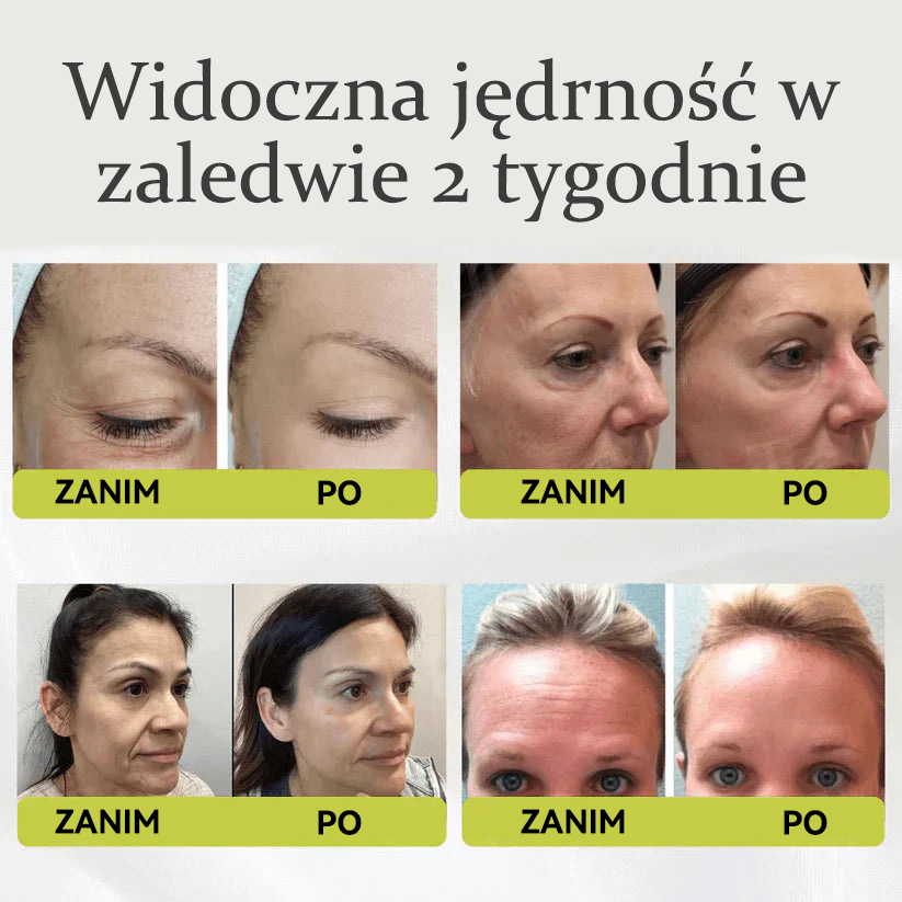 🎄🎄Dumnie opracowane i zatwierdzone przez polskie instytucje💫Tiworld® Zaawansowany krem liftingująco-odnawiający z peptydami o działaniu podobnym do botoksu + retinolem Vita-A – tylko dziś 70% zniżki