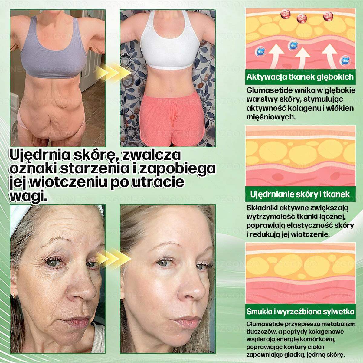 💞Oficjalny Sklep | 👩‍⚕️🎁 𝐏𝐙𝐆𝐎𝐍𝐄® Superfood 𝑵𝒂𝒏𝒐 Mikronakłuwana Plaster 🇵🇱(Tylko raz dziennie, widoczne zmiany już w 7 dni)✅ Na otyłość, 🅛🅞🅞🅢🅔 🅢🅚🅘🅝 wiotką skórę, cukrzycę, bezdech senny, problemy ze stawami i wiele więcej