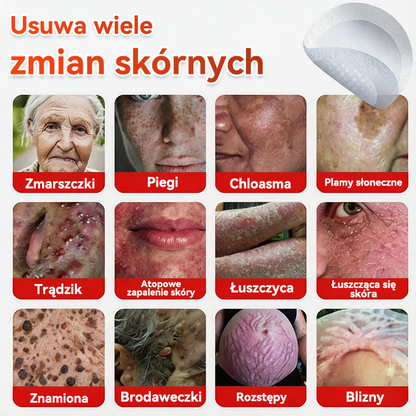 ✅✅ GFOUK® Plastry do usuwania brodawek i znamion z mikronakłuciami roślinnymi