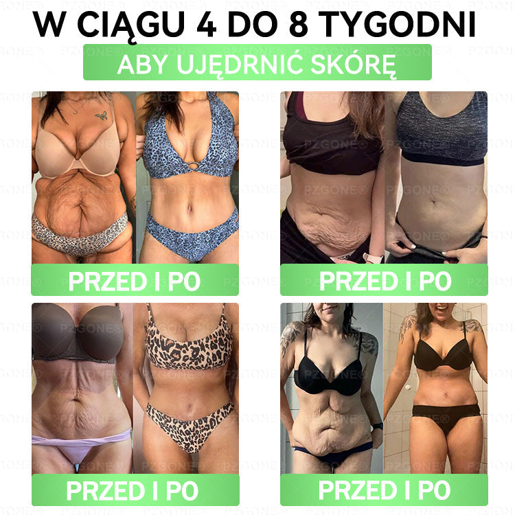 💞Oficjalny Sklep | 👩‍⚕️🎁 𝐏𝐙𝐆𝐎𝐍𝐄® Superfood 𝑵𝒂𝒏𝒐 Mikronakłuwana Plaster 🇵🇱(Tylko raz dziennie, widoczne zmiany już w 7 dni)✅ Na otyłość, 🅛🅞🅞🅢🅔 🅢🅚🅘🅝 wiotką skórę, cukrzycę, bezdech senny, problemy ze stawami i wiele więcej